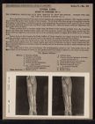 Upper Limb. Front of Forearm - no. 1